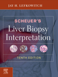 Liver Biopsy Interpretation