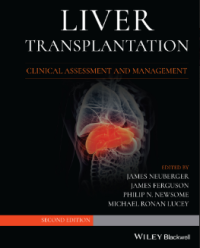 Liver Transplantation Clinical Assessment and Management