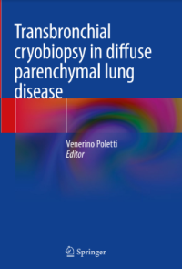 Transbronchial cryobiopsy in diffuse parenchymal lung disease