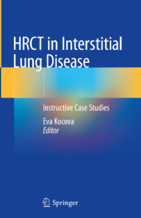 HRCT in Interstitial Lung Disease