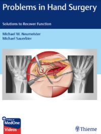 Problems in Hand Surgery