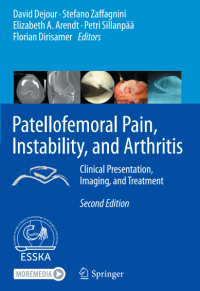 Patellofemoral Pain, Instability, and Arthritis